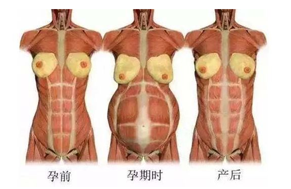 產(chǎn)后媽媽骨盆修復(fù)――帶你回到完美身材！