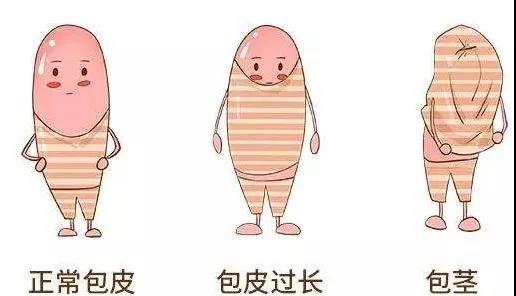 【保山安利醫(yī)院】家長速看！暑期包皮手術(shù)預(yù)約正當時！