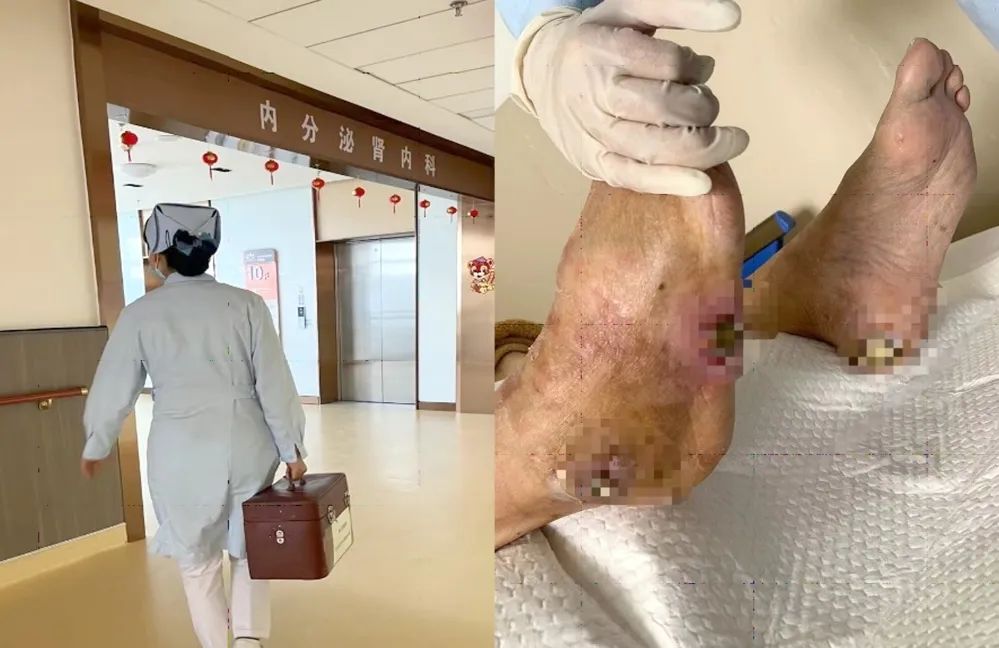 【保山安利醫(yī)院】傷口治療一站式，健康生活零距離！